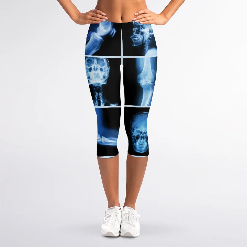 X-Ray Film Radiology Print Women's Capri Leggings Stylish Yoga Leggings